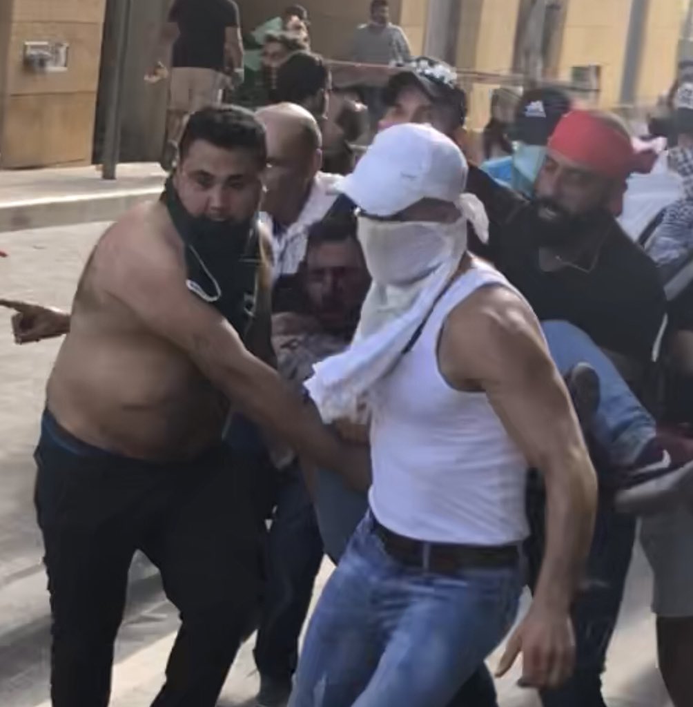 A protester was shot in the eye by a rubber bullet in downtown Beirut. Lebanon